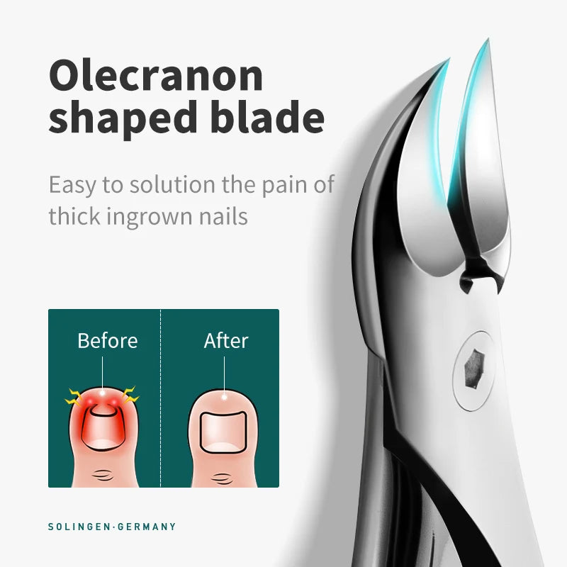 MR.GREEN Nail Clippers Toenail Cutters Pedicure Manicure Tools Anti-Splash Ingrown Professional Correction Tool Sets