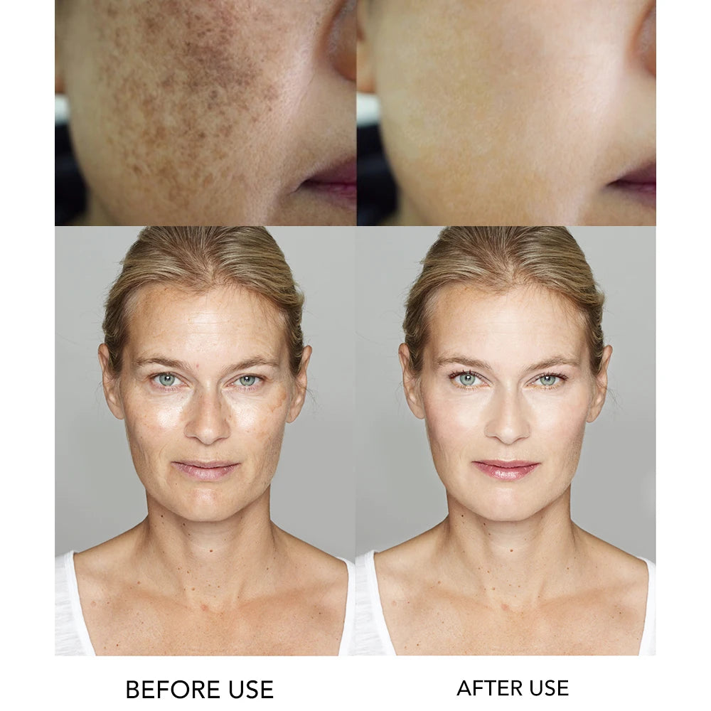 AILKE Amino Acid Whitening Facial Cleanser, Deeply Clean Skin, Reduce Dark Spots, Stains, Oil Control, Anti Acne, Blackheads