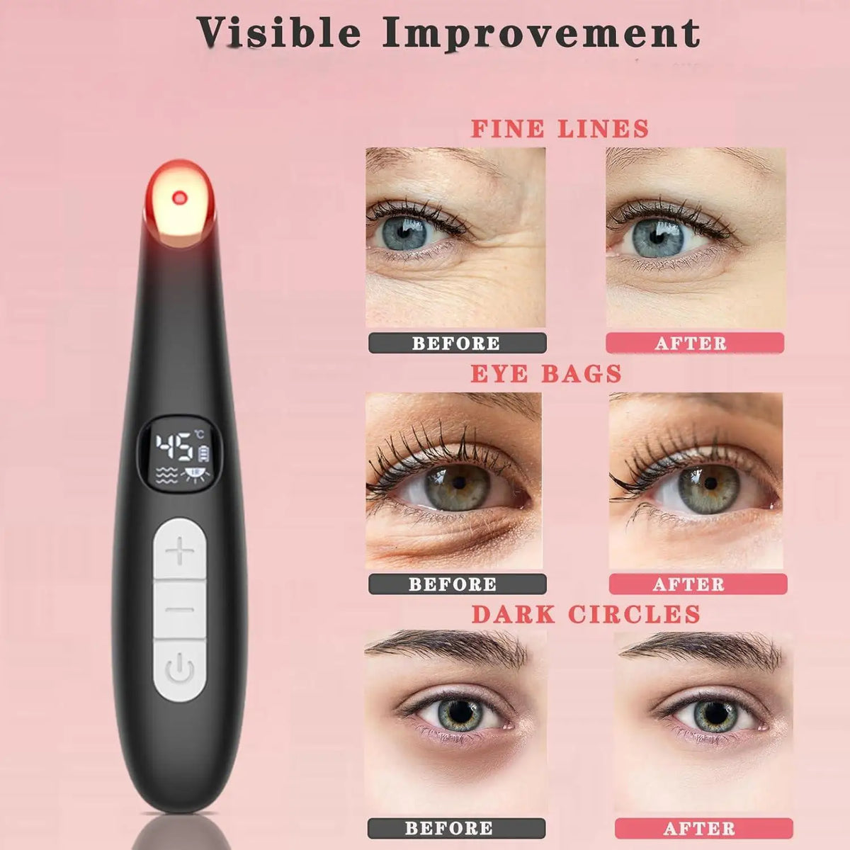 3 in 1 Eye Massager Wand Eye Lift Wand Beauty Device with Vibration Red Light for Dark Circle Puffiness and Fine Lines