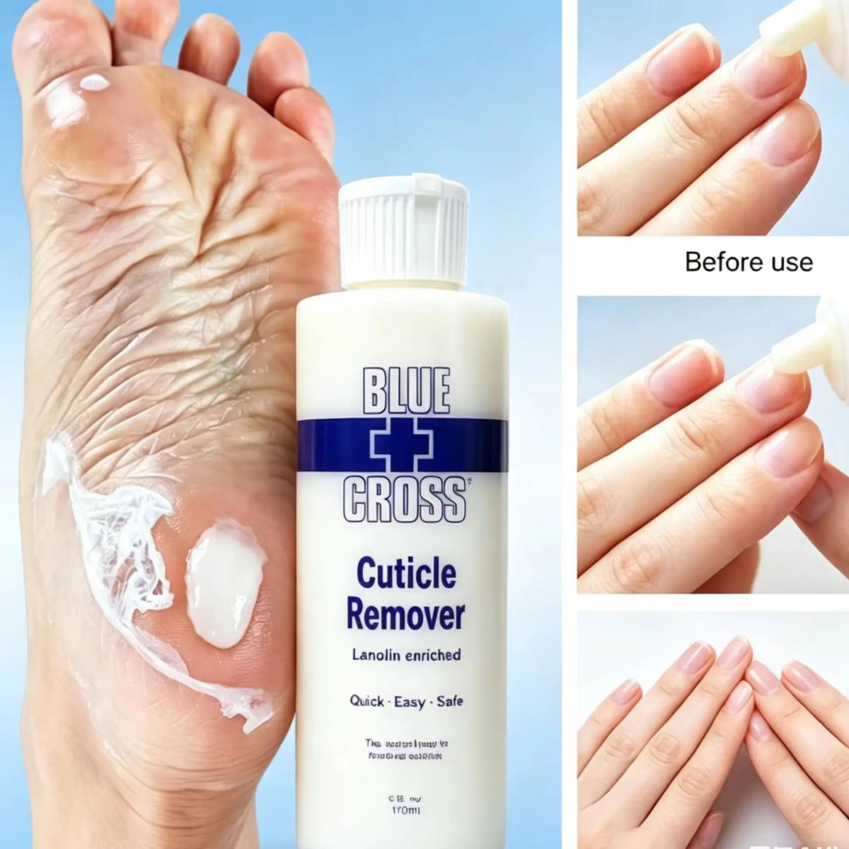 30/177/473Ml Nail Cuticle Removal Gel Cream Foot Cuticle Remove Soften Dead Skin Foot Exfoliation Softener