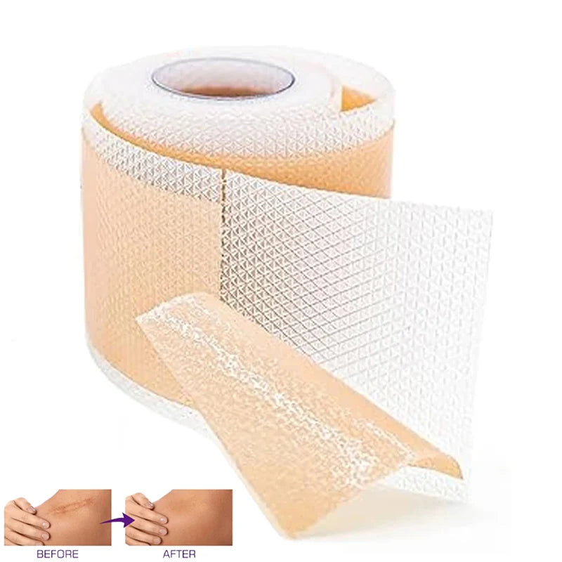 1 Roll Silicone Scar Sheets, Waterproof Breathable Tape, Self-Adhesive Scar Cover Patch for Skin, Face, Body, Invisible Fade