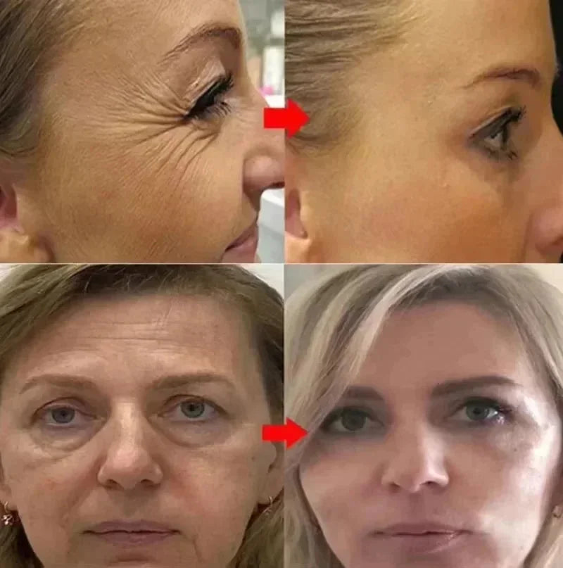 Facial Retinol Serum Whitening Moisturising Fade Fine Lines Anti Wrinkle Anti Ageing Rejuvenate Your Face Korean Cosmetics 30ml
