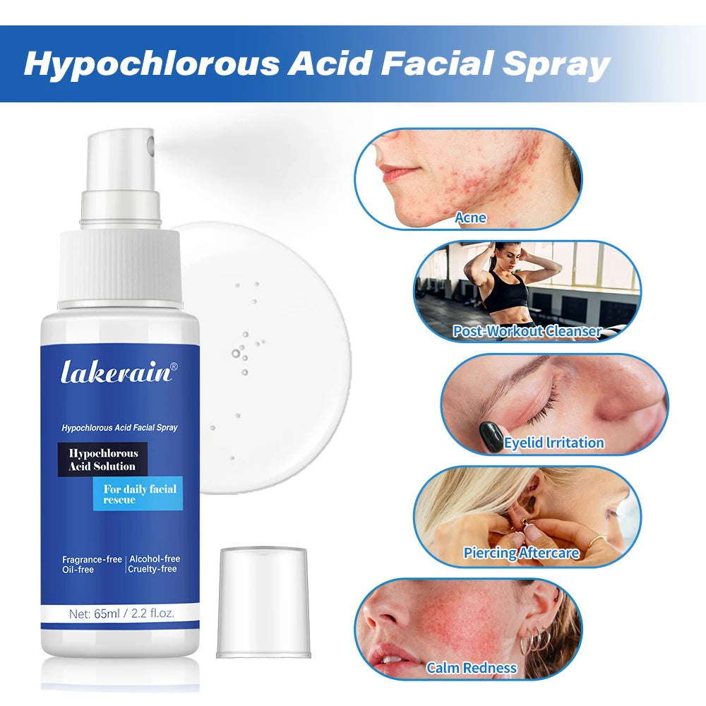 Hypochlorous Acid Facial Spray Reduce redness swelling acne Versatile uses for every skin Calm Redness Eyelid lrritation Care Sk