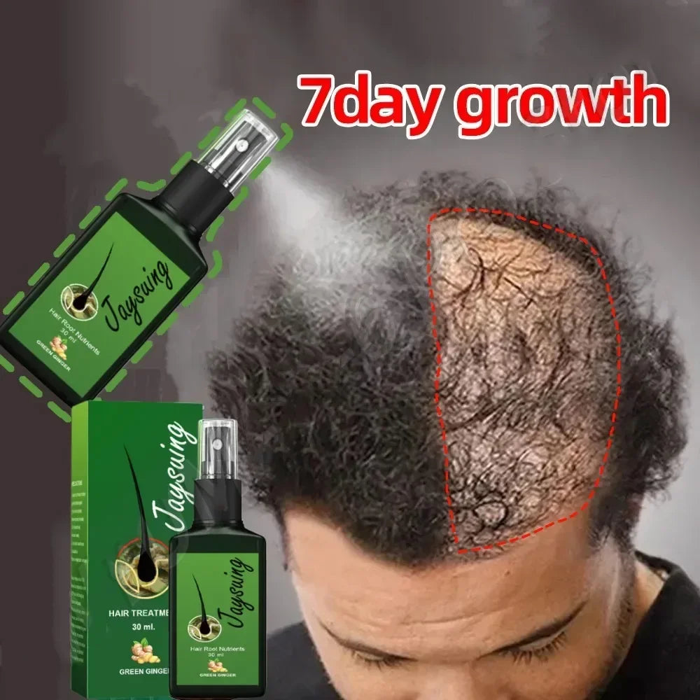 Fast Ginger Hair Growth Spray Roots Grow Anti Hair Loss Hair Regrowth Serum Scalp Damaged Repair Nourish Care Products Women Men
