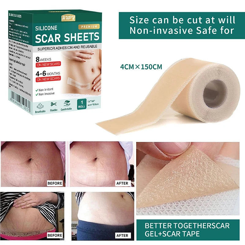 Z. 1 Roll Silicone Scar Sheets Gel Scar Patch 4cmX150cm Self-Adhesive Scar Cover Tape Reusable And Effective Skin Care Strips