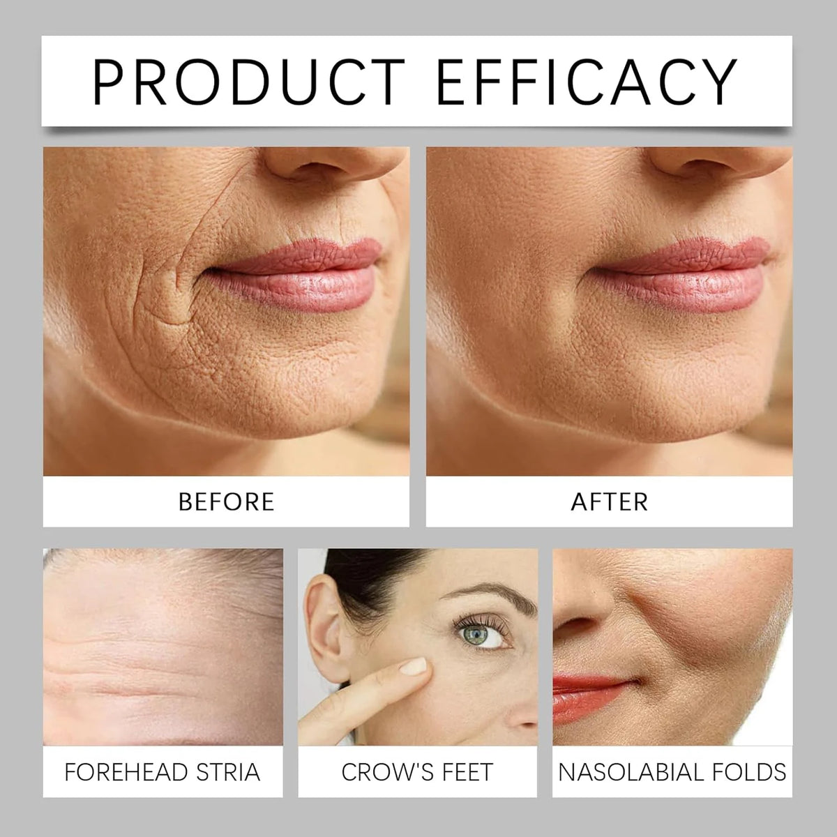 Botax Bliss Elixir Anti-Aging Cream: Bee Venom/Retinol, Moisturizing & Firming, Reclaims Youthful Vibrancy