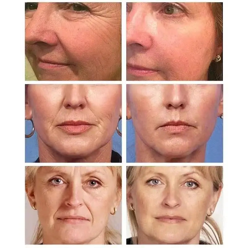 Retinol Wrinkle Removing Face Cream Anti-Aging Firming Lifting Fade Fine Lines Moisturizing Brighten Skin Care Korean Cosmetics