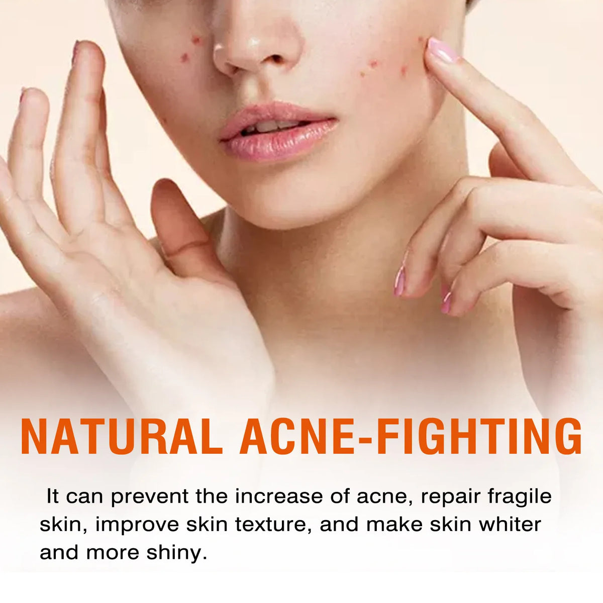 Salicylic Acid Mask Fade Acne Marks Blackheads Removal Shrink Pores Cleansing Repair Nourish W-hitening Pimple T-reatment Cream