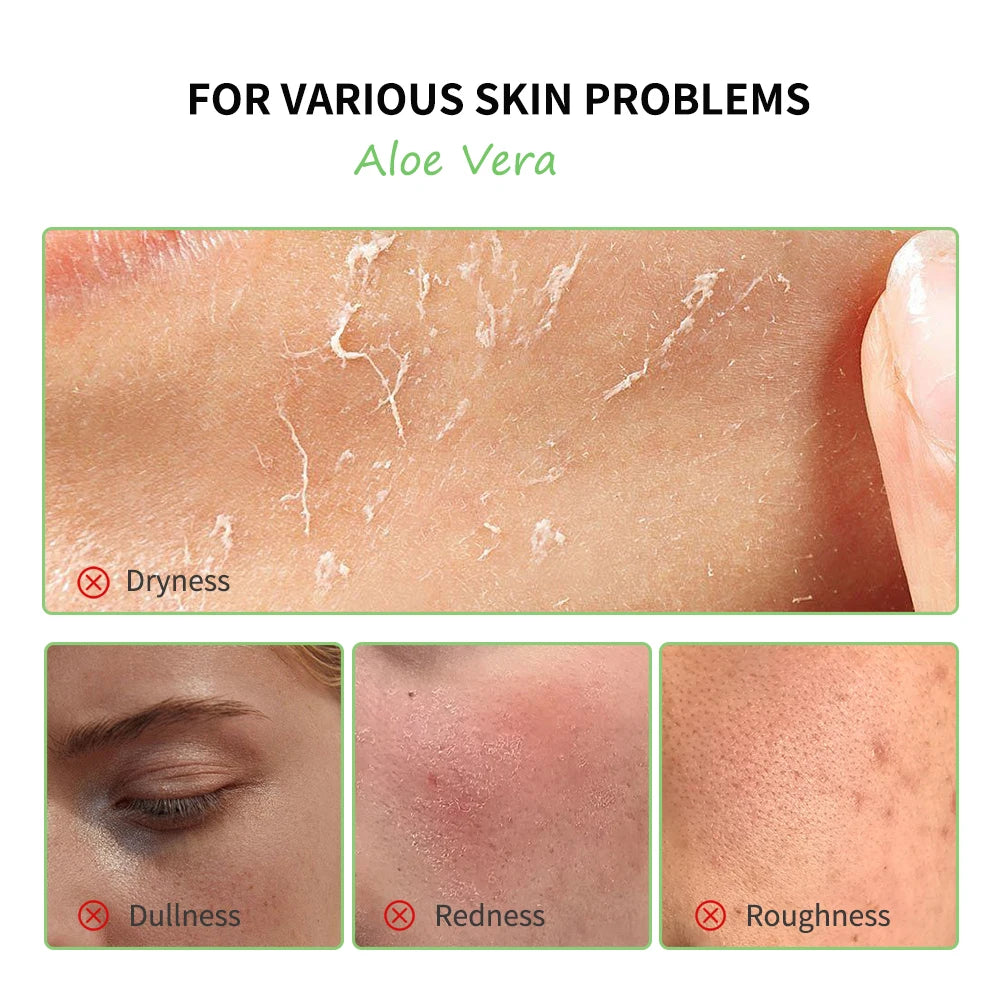 Aloe Vera Gel Lightening Moisturizing Soothing Natural Organic Aloe Vera Gel Reduce Redness Hydrate Exfoliation Skincare