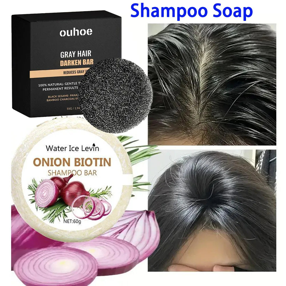55g/60g Onion Rosemary Shampoo Soap, Handmade Soap Oil Control And Dandruff Removal Soap For Both Men & Women