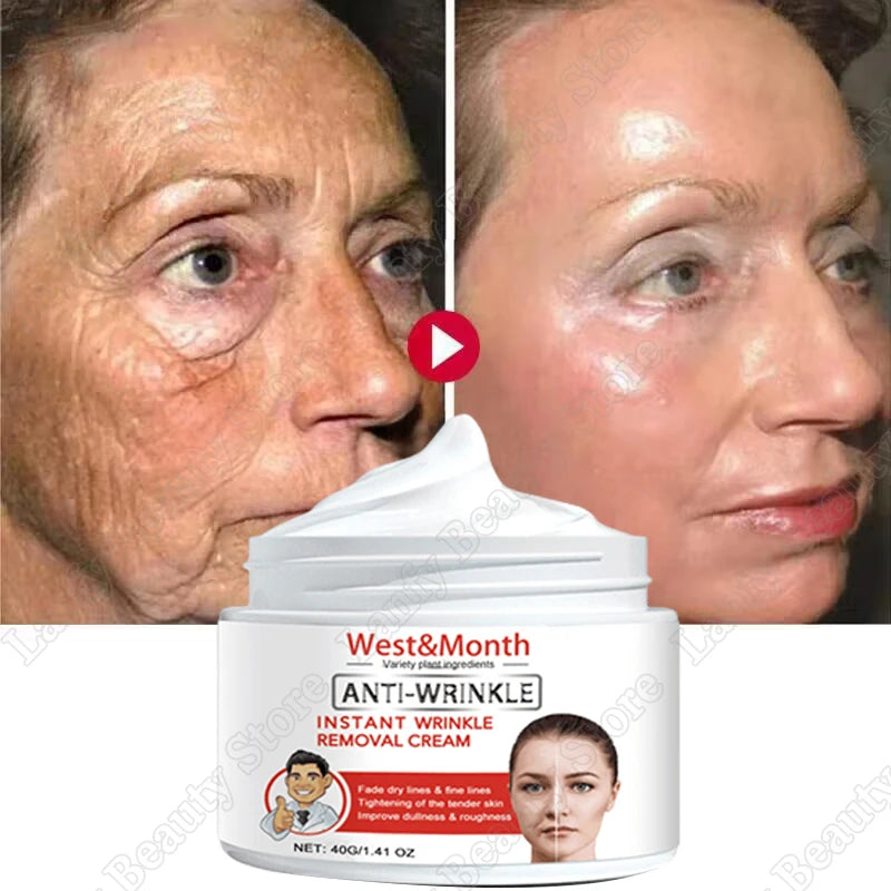 Retinol Wrinkle Removing Face Cream Anti-Aging Firming Lifting Fade Fine Lines Moisturizing Brighten Skin Care Korean Cosmetics