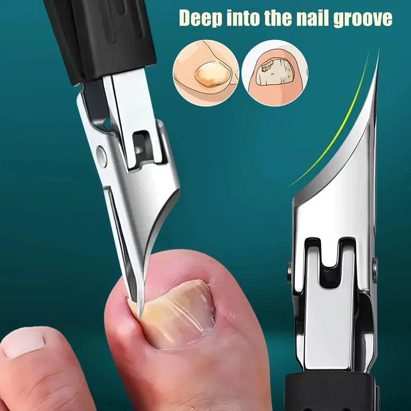 5pcsIngrown Toenail Clipper Set with Beak Pliers,Nail Care Tools for Thick Hard Nails,Stainless Steel Wide-Opening Nail Clippers