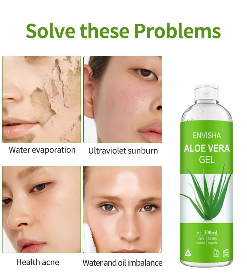 ENVISHA Aloe Vera Gel Soothing Moisturizing Hyaluronic Acid Sunburn Repairing Treatment Skin Care Face Body Cream Antipruritic