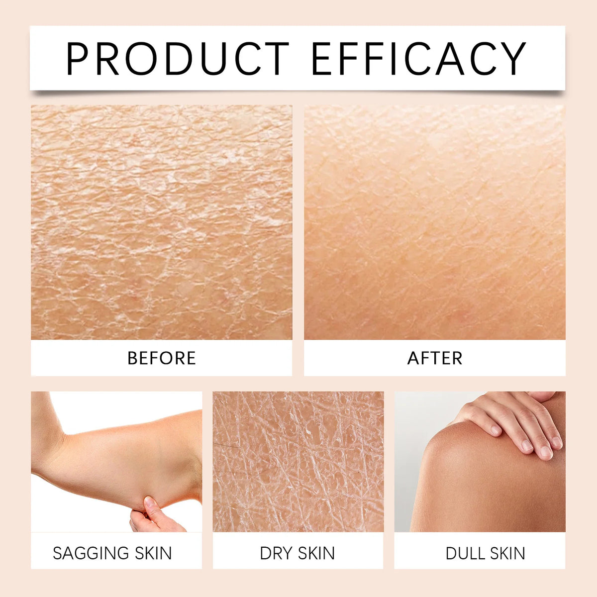 Shea Butter Moisturizing Cream,Double-Oil Deep Nourishment,Body&Face Firming Anti-Aging, Instant Relief For Strawberry Legs&KP Whipped Butter Texture,Preventing & Fading  Marks,Ultimate 48H Skin Barrier Rescue,Suitable For Al