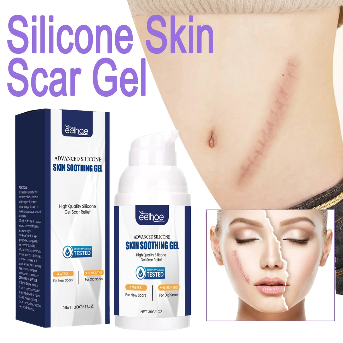 EELHOE Silicone Skin Scar Gel Retinol Niacinamide Scars Stretch Marks Burn Marks Deeply Nourish Skin Reduce Redness Swelling 30g