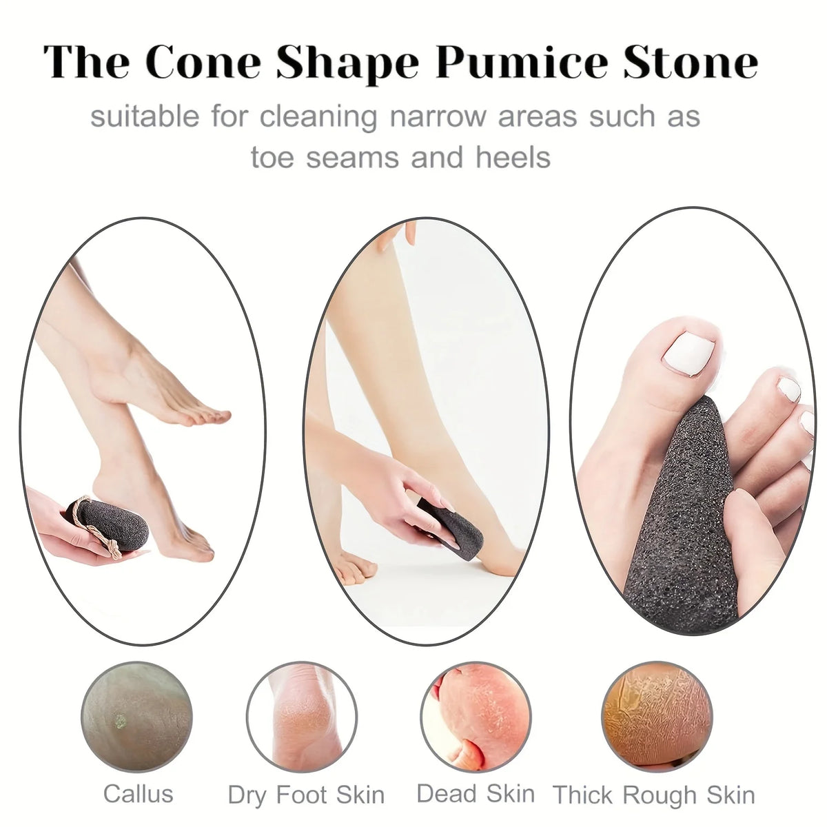 1pc/3pcs Volcanic Pumice Foot Care Tool, Used for Treating Severe Calluses, for Removing Dead Skin from the Feet and Hands, for