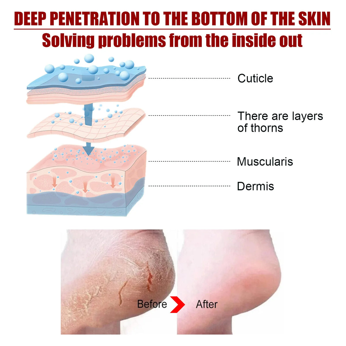 Foot Fruit Acid Exfoliating Peel Mask Dry Rough Cracked Feet, Soothing Your Feet & Heel, Make Feet Smooth And Soft Pure natural