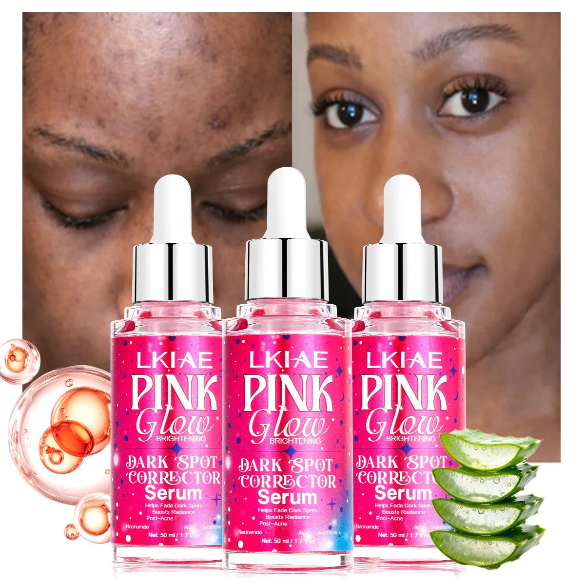 LKIAE Pink Glow Dark Spot Corrector Serum, Boost Radiance, With Nicotinamide, Glutathione, Reduce Post-Acne Hyperpigmentation