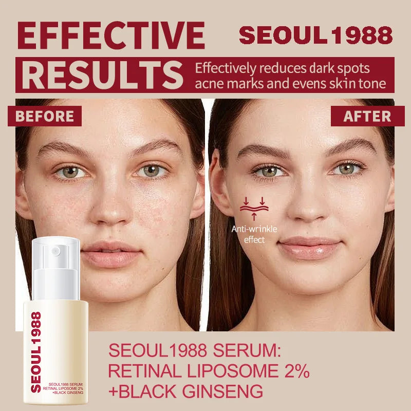 1/2/3PCS Korean SEOUL 1988 Retinol Face Serum Fade Fine Wrinkle Moisturizing Whitening Remove Spot Shrink Pores Beauty Skin Care