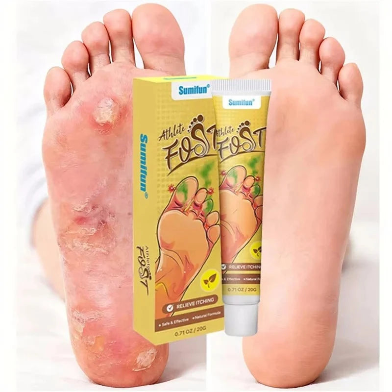 Anti-Foot Fungus Ointment Deodorant Care Products Foot Deodorant Creams Antiseptic and Antiperspirant Foot Skin Topical Cream